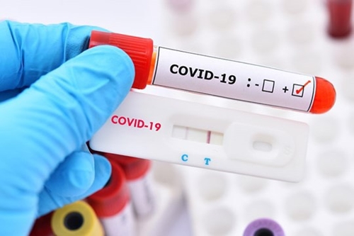 Bộ Y tế nói về việc kit xét nghiệm COVID-19 khan hiếm và loạn giá